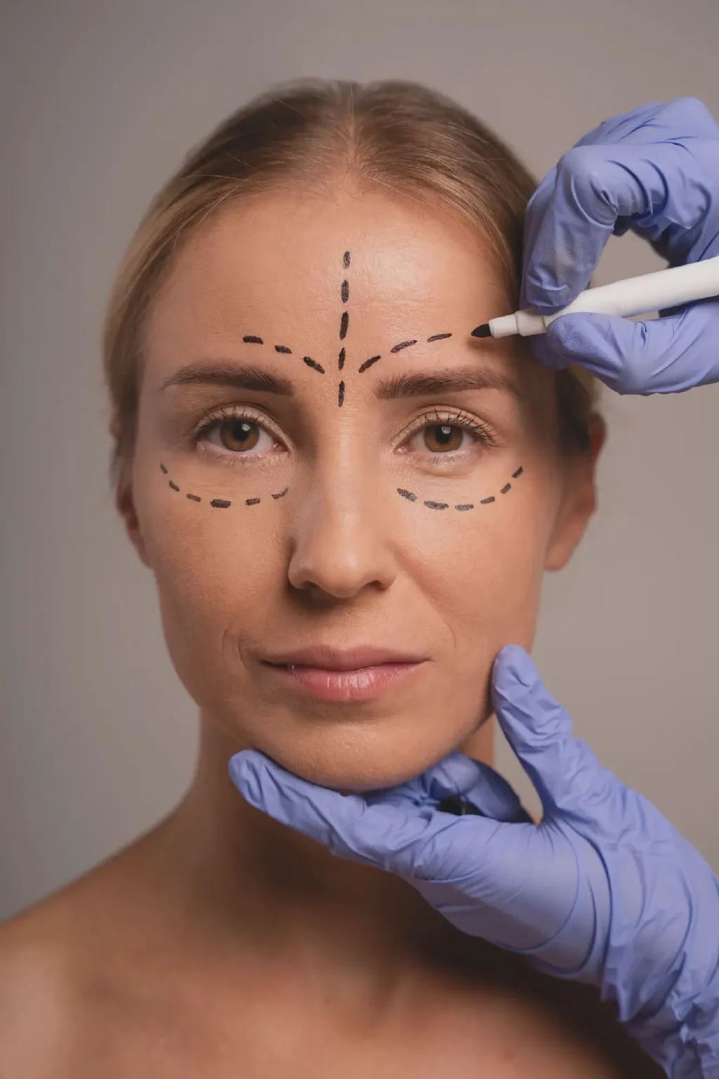 Blepharoplasty Procedure